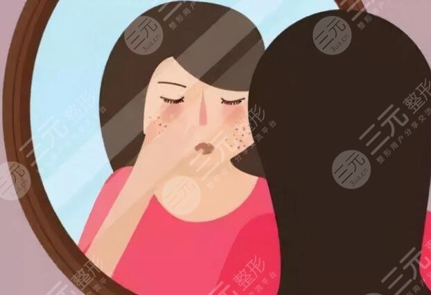 去除黃褐斑價格大概是多少?