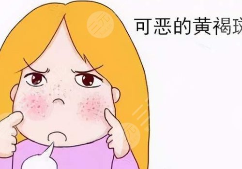 激光祛斑會(huì)不會(huì)反彈？