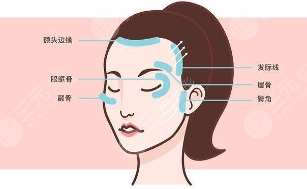面部下垂整形多久恢復正常狀態(tài)？恢復期通常為1個月！