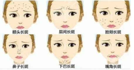 簡(jiǎn)單的祛斑方法有哪幾種見(jiàn)效快?