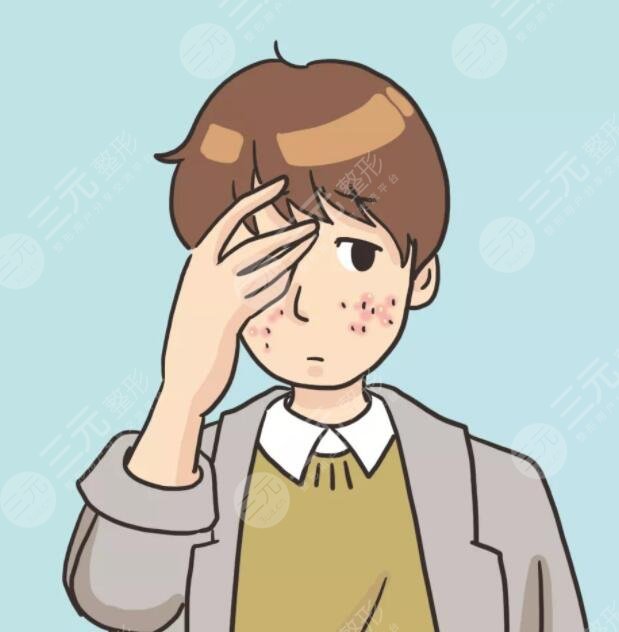 男生祛痘的小竅門是什么？做好這5點可以大大緩解痘??！