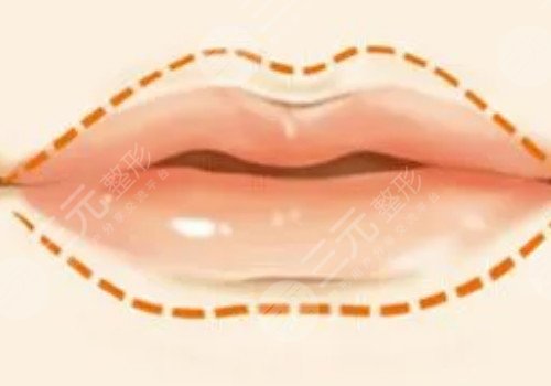 唇部注射玻尿酸會(huì)栓塞嗎？