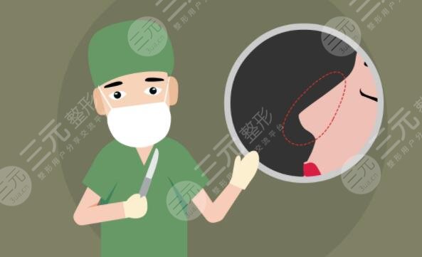 隆鼻假體哪種材料好?