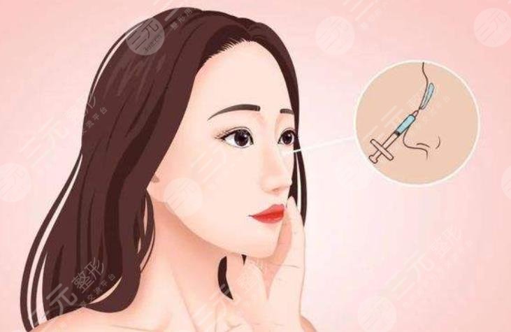 玻尿酸隆鼻有副作用嗎