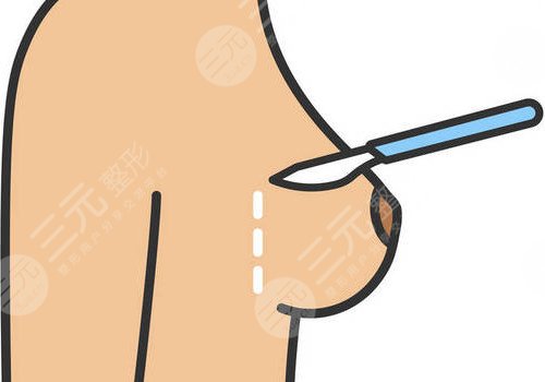 隆胸腋下切口的優(yōu)勢和缺點有哪些？