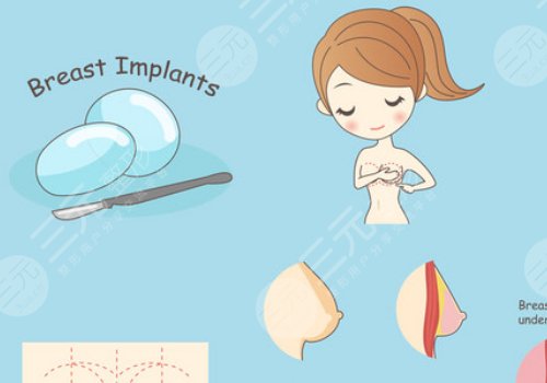 假體豐胸如何避免包膜痙攣？