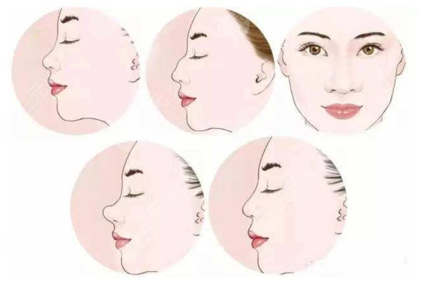 鼻翼整形手術(shù)多少錢(qián)