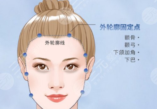 輪廓整形1個月和6個月對比圖