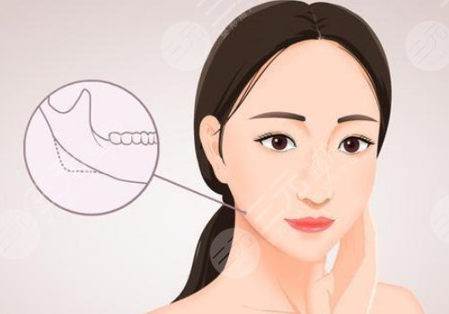 面部輪廓固定多少錢