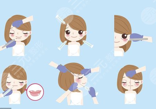 蔡海亮拉皮怎么樣