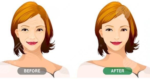 柳民熙醫(yī)生擅長項(xiàng)目