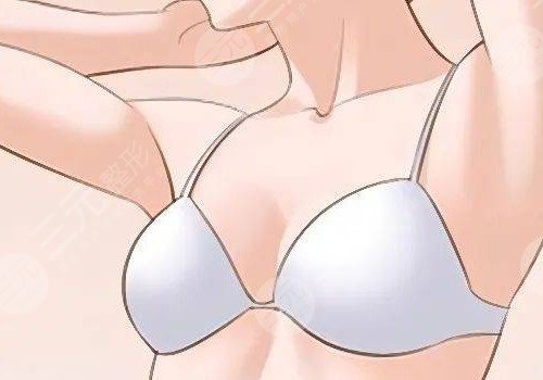 光面假體容易包膜攣縮嗎？會移位嗎？