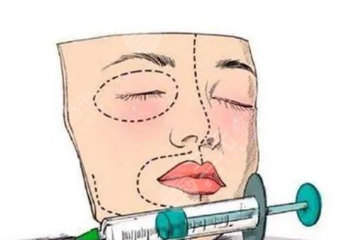 面部脂肪填充多久能恢復(fù)自然？