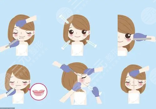 面部脂肪填充多久能恢復(fù)自然？