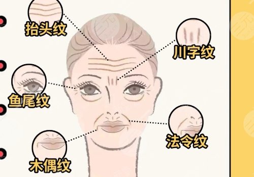 微調(diào)整形有風(fēng)險(xiǎn)嗎？