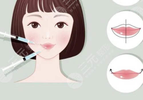 微調(diào)整形有風(fēng)險(xiǎn)嗎？