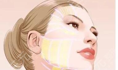 臉部吸脂加黃金微雕多少錢？價格表公開！緊致臉型攻略get~