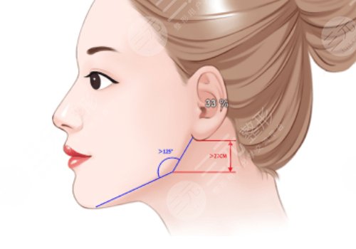 面部輪廓整形有什么后遺癥？