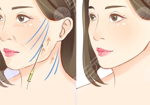 蔡海亮做v美減齡效果好嗎?