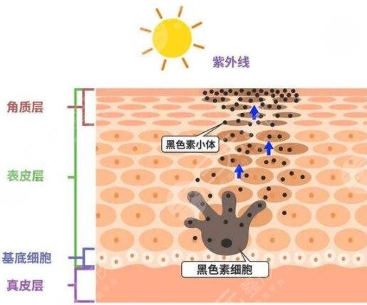 祛斑的方法以及注意事項