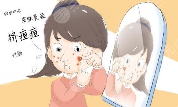 痤瘡佳緩解方法