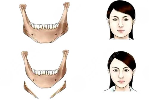 面部內(nèi)輪廓和外輪廓區(qū)分