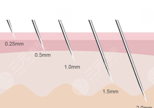 微針美塑和黃金微針的區(qū)別盤點