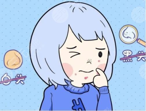 去黑頭有效的方法有哪些起效快速？5個(gè)好用的方法，一周一次