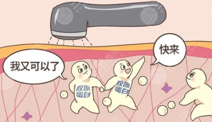 膠原蛋白填充臉部維持多久？