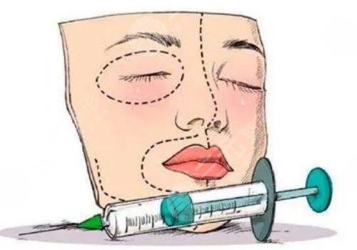 微調(diào)整形都有什么項(xiàng)目?