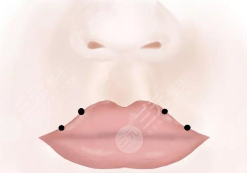 縮短人中的幾種方法