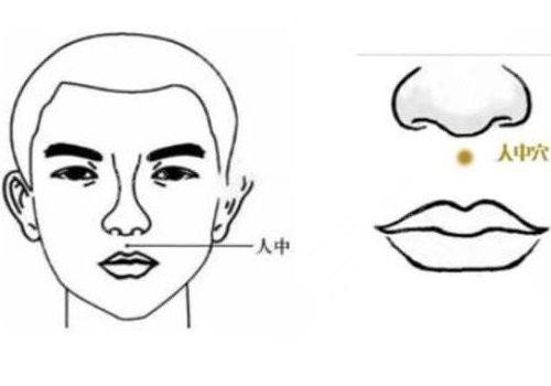 縮短人中的手術(shù)危險(xiǎn)嗎？