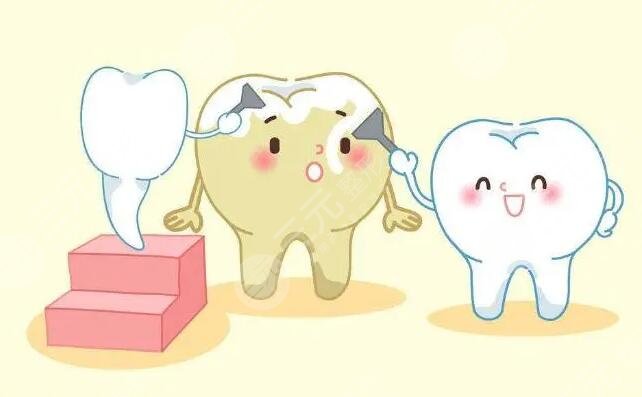 冷光牙齒美白的幾個(gè)步驟是什么?