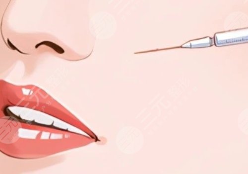 臉部微調(diào)大概多少錢？包括哪些項(xiàng)目？