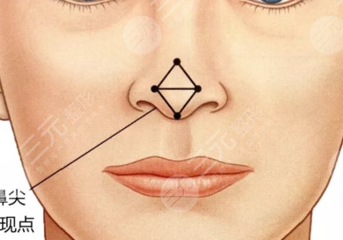 安徽維多利亞整形醫(yī)院怎么樣？