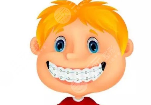 牙齒矯正多少錢價(jià)格表2023