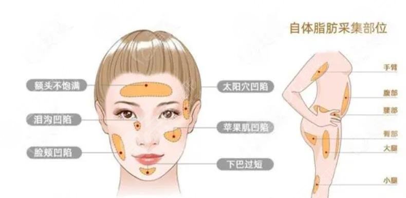 清華大學(xué)玉泉醫(yī)院美容整形中心擅長(zhǎng)項(xiàng)目