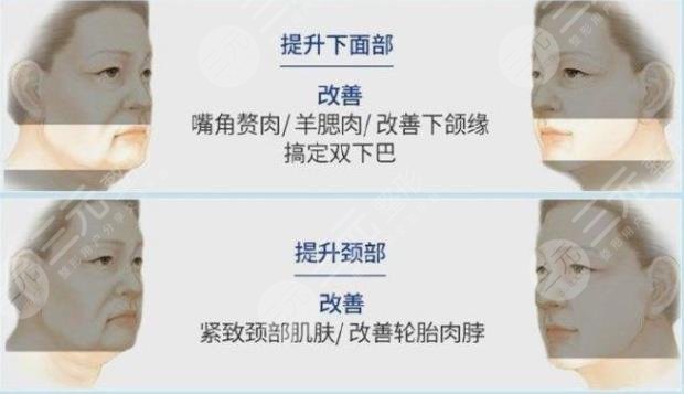 臉部吸脂加黃金微雕多少錢？價格表公開！緊致臉型攻略get~