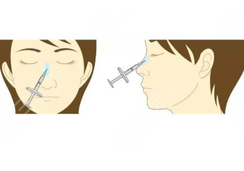 微創(chuàng)整形美容診療范圍有哪些？