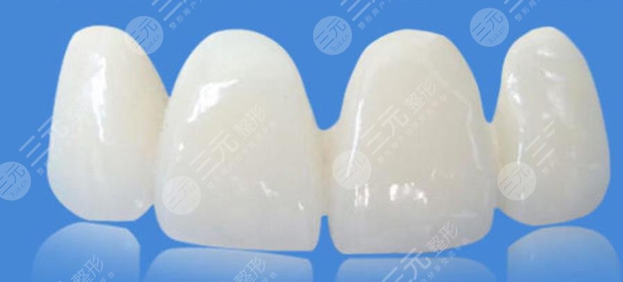 全瓷牙