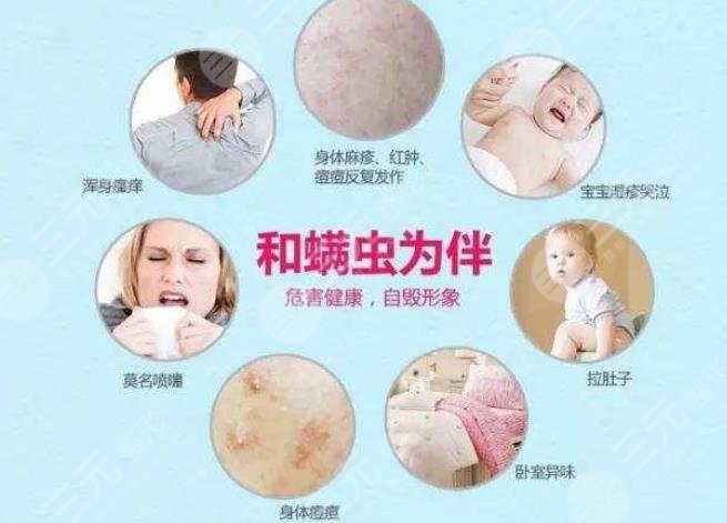 螨蟲感染皮膚的癥狀