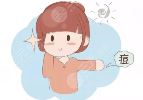 祛痘痘疤藥膏哪個好?