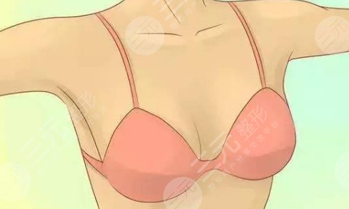 強(qiáng)生傲諾拉和曼托區(qū)別在哪？