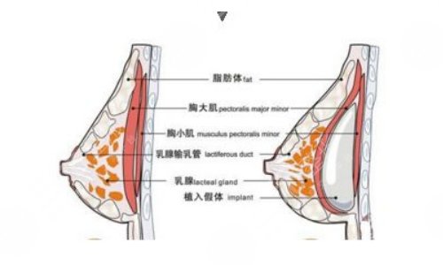 強(qiáng)生傲諾拉和曼托區(qū)別在哪？