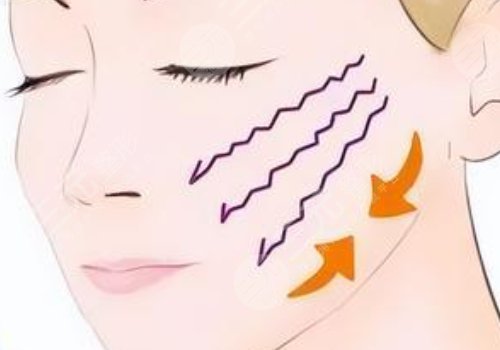 筋膜復(fù)位術(shù)能保持多久?