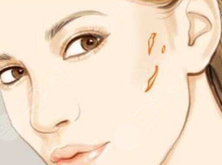 祛除疤痕的有效方法有哪些?