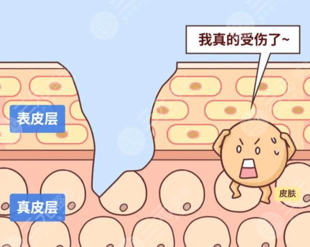 祛除疤痕的有效方法有哪些?