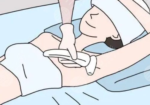 脫毛用哪種方法好？