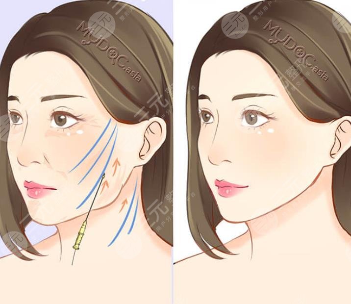 王成元醫(yī)生擅長項(xiàng)目