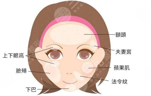 臉部皺紋怎樣去除?